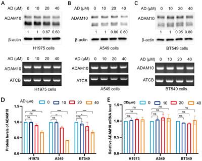 A disintegrin and metalloproteinase domain 10 expression inhibition by the small molecules adenosine, cordycepin and N6, N6-dimethyladenosine and immune regulation in malignant cancers